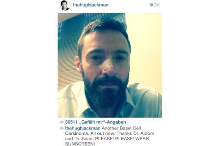 Hugh Jackman wieder wegen Hautkrebs behandelt